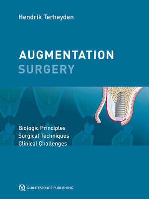 cover image of Augmentation Surgery